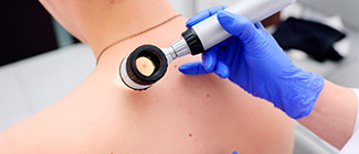 Дерматоскопия кожи Дерматоскопия кожи